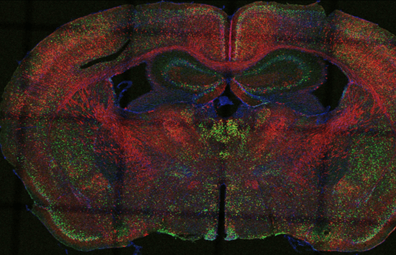 Fairness of Machine Learning in medical Image Analysis